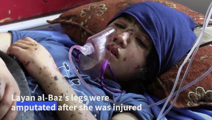 'I want my legs back': the child amputees of Gaza's war