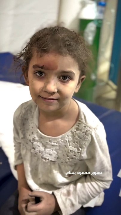 Kabar terbaru Gaza Palestina-Senyum seorang gadis kecil yang terluka di gaza palestina