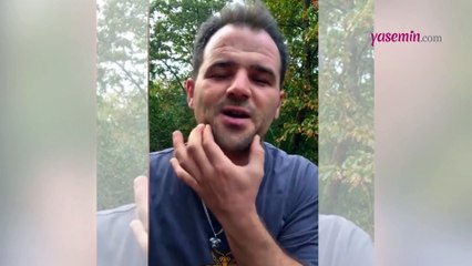 Arının iğnesi ile dudaklarını şişirdi! 'Bir botoks komedisi' diyerek paylaştı