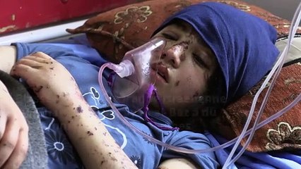 "Rattachez-moi mes jambes": l'effroi des enfants amputés dans Gaza en guerre
