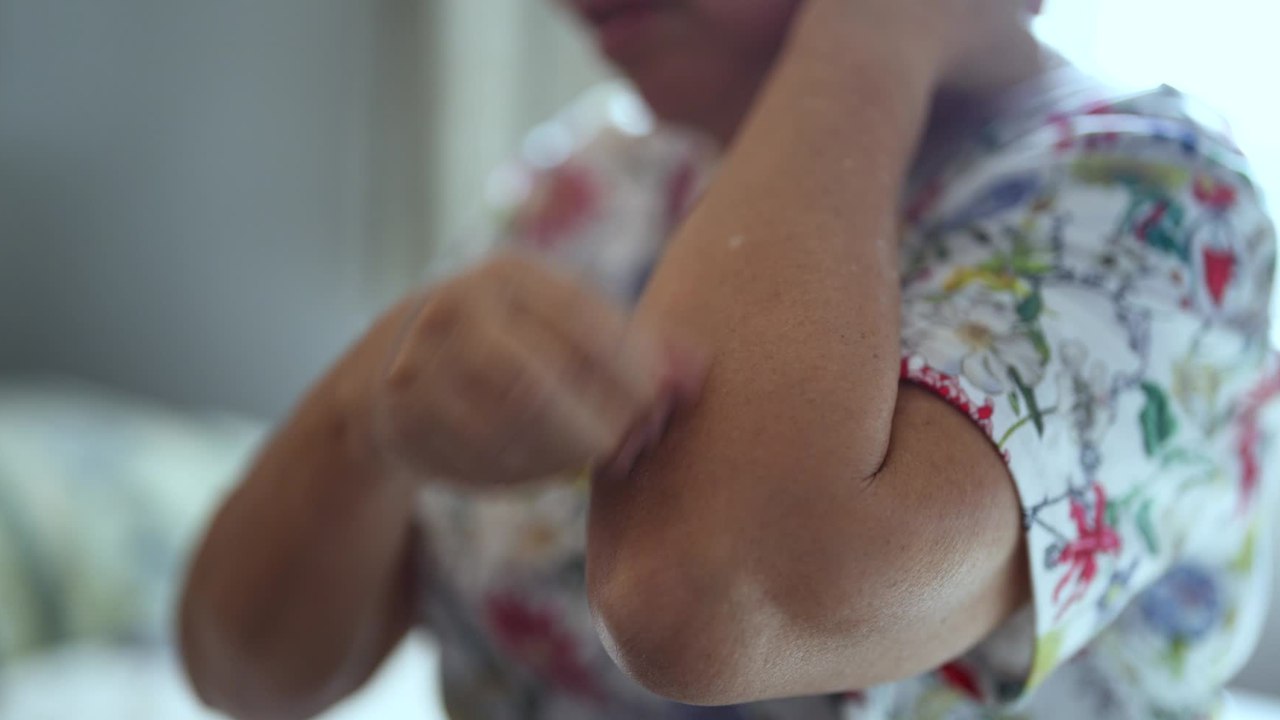 Sudden itching could be a sign of pancreatic cancer