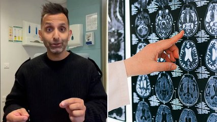 Five tips to reduce risk of getting dementia, according to Dr Amir Khan
