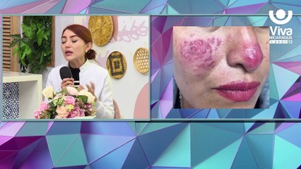 Conoce más de las lesiones acneiforme