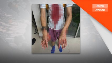 Lelaki cedera ditetak dalam cubaan samun ketika joging