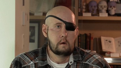 World’s first eye transplant carried out on US veteran
