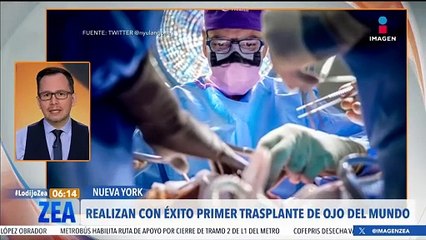 Realizan con éxito el primer trasplante de ojo del mundo