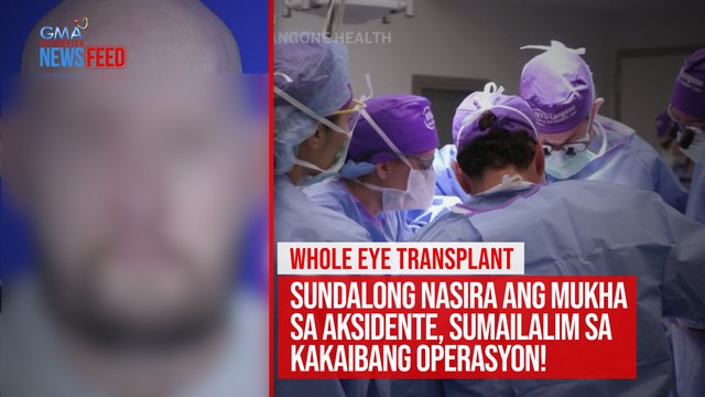 Sundalong nasira ang mukha sa aksidente, sumailalim sa kakaibang operasyon! | GMA Integrated Newsfeed
