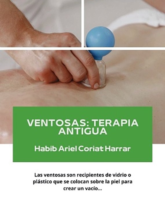 |HABIB ARIEL CORIAT HARRAR | TERAPIA ANTIGUA: VENTOSAS (PARTE 3) (@HABIBARIELC)