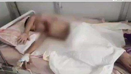 भीलवाड़ा: खेल-खेल में दीपक से मासूम के कपड़ो में लगी आग, गंभीर झुलसा बालक