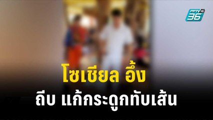 โซเชียล อึ้ง ถีบ แก้กระดูกทับเส้น | โชว์ข่าวเช้านี้ | 14 พ.ย. 66