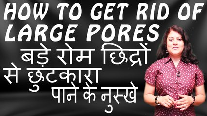 HOW TO GET RID OF LARGE PORES II बड़े रोम छिद्रों से छुटकारा पाने के नुस्खे  II