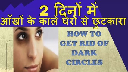 2 दिनों में आँखों के काले घेरों से छुटकारा | Remove Dark Circles In Just 2 Days | UMBJ _