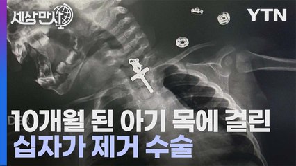 [세상만사] 십자가를 삼킨 10개월 된 여자 아기 / YTN