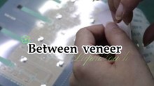 Between veneer