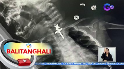 Nalunok na pendant ng isang bata, natukoy matapos i-xray | BT