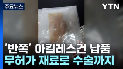 '반쪽' 아킬레스건 병원에 납품...무허가 재료로 수술까지 / YTN