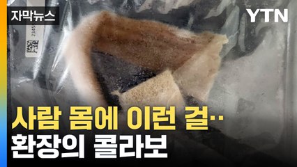 [자막뉴스] 이상한 아킬레스건 갖고 다니며 불법 의료 행위까지... 6천5백여 명이 당했다 / YTN