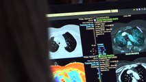 Expertos en radiología comparten conocimientos sobre tecnología espectral en Madrid