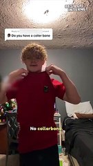 Embracing Life Without a Collarbone || Best of Internet