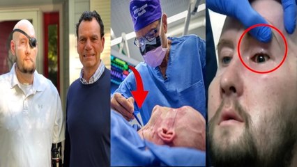 World's First Eye Transplant हुआ Succesful| New York Surgeon का दावा Blindness से मिलेगा छुटकारा