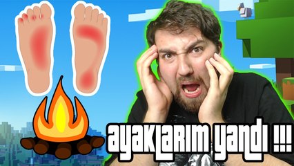 AYAKLARIM YANDI !!! Minecraft Hayran Haritası