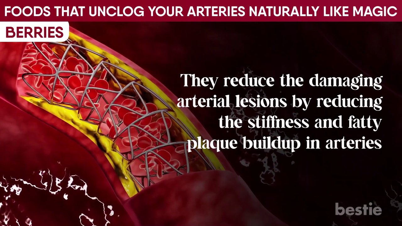 These 12 BEST Foods Can Help UNCLOG Arteries & Decrease Heart Attacks-2023-TechFit with Meer