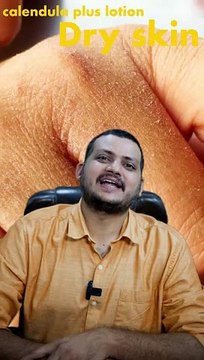 Homeopathic Lotion I For Dry Skin I Calendula Plus Lotion I Winter Season