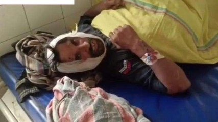 अशोकनगर: दबंगो ने युवक पर बरसाए लाठी-डंडे, किया लहूलुहान