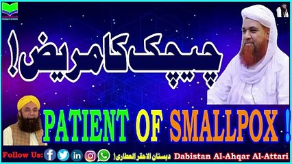 Chichak Ka Mareez | Patient of Smallpox | Nice | Dabistan Al Ahqar Al Attari | Muhammad Tariq Rashidk