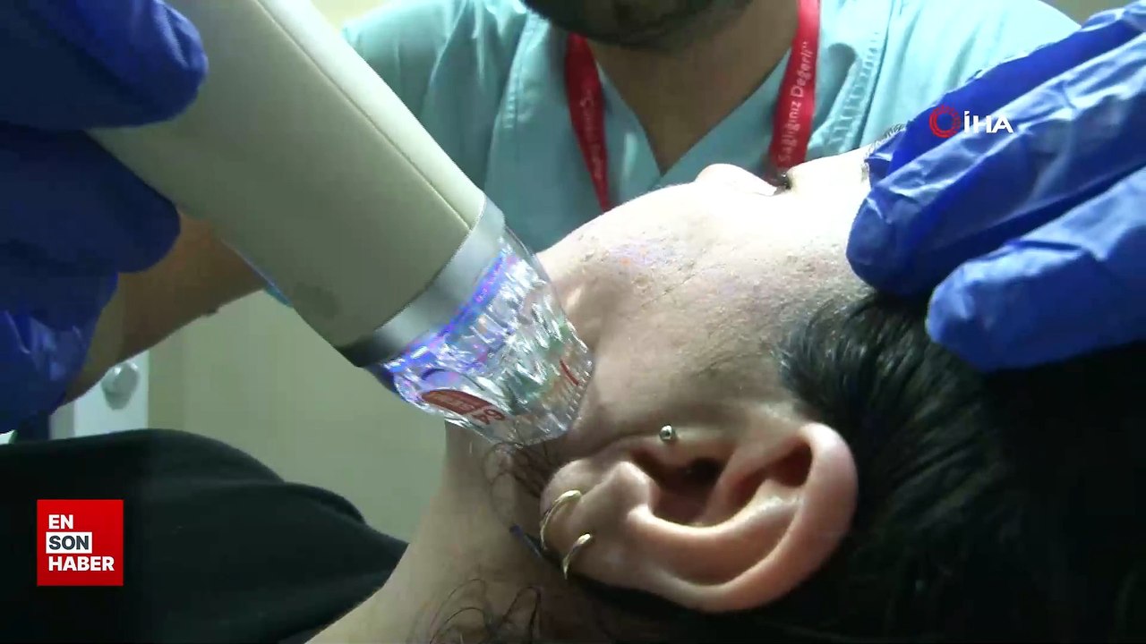 Güzelliğin anahtarı altın iğne tedavisinde