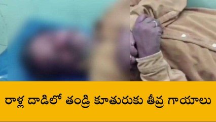 అన్నమయ్య జిల్లా: వర్షపు నీరు వివాదం... తండ్రి కూతుళ్లపై రాళ్లదాడి