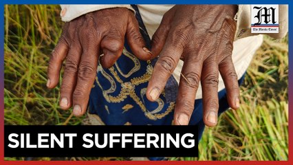 Action pressed on climate's impact on women's health