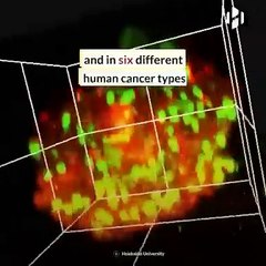 Japonlar kansere karşı hidrojel üretti