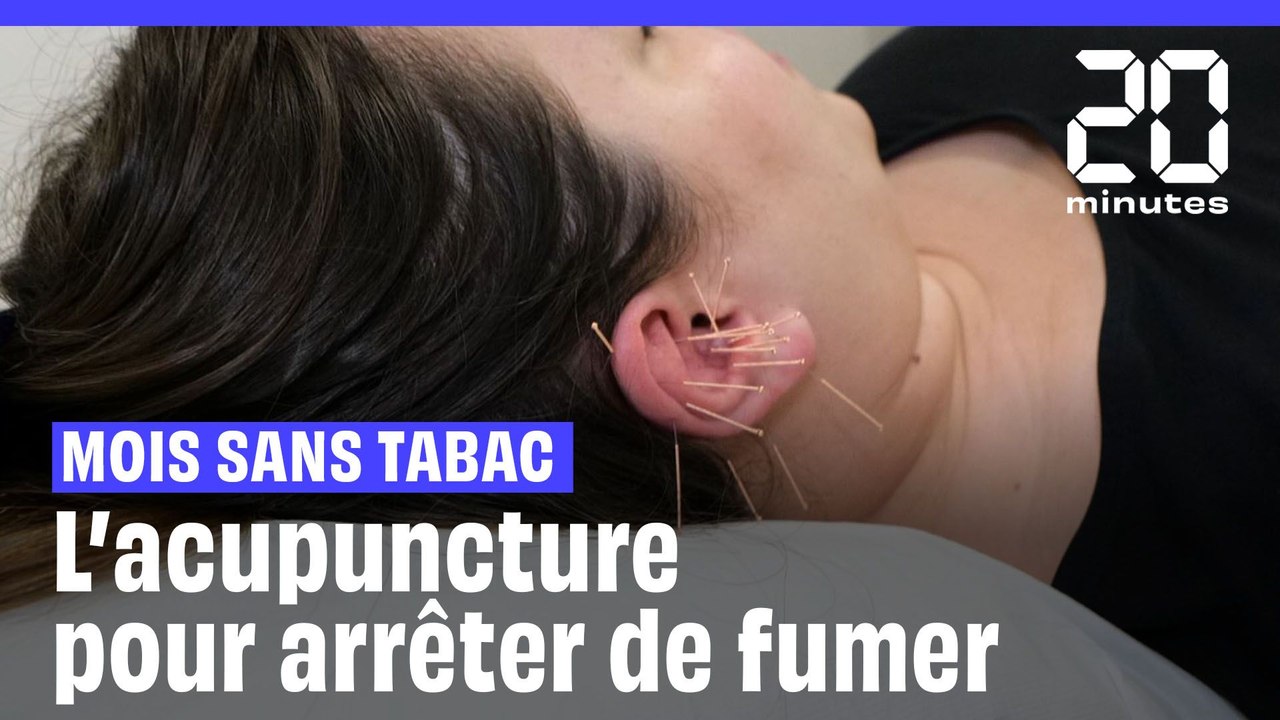 Mois sans tabac : Et si vous essayiez l'acupuncture (dans l'oreille) pour arrêter de fumer ?