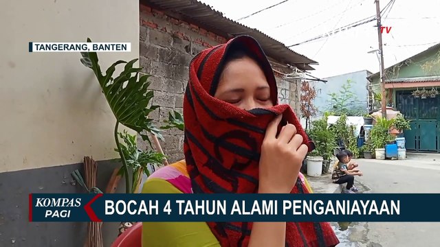 Seorang Bocah Usia 4 Tahun di Tangerang Dianiaya Ibu Tiri