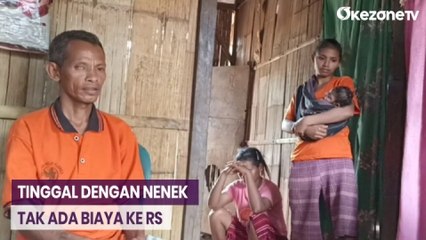 Miris! Balita Gizi Buruk di Sikka, Setiap Hari Makan Ubi dan Pisang