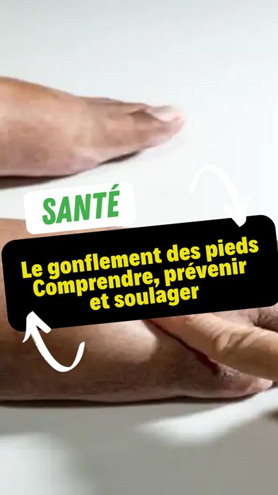 Le gonflement des pieds : Comprendre, prévenir et soulager