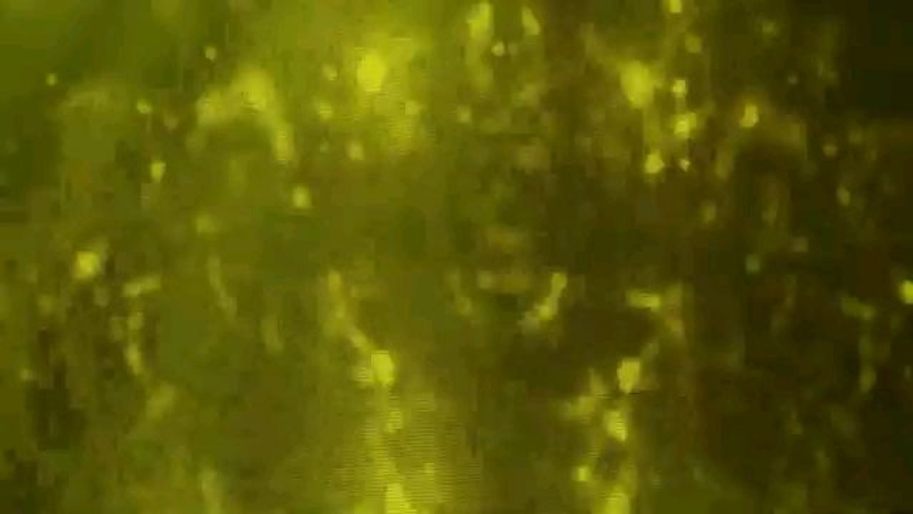 Jelena Marinkov - Lek protiv bola - Nedeljno popodne sa Leom Kis - (Tv Grand 19.11.2023)