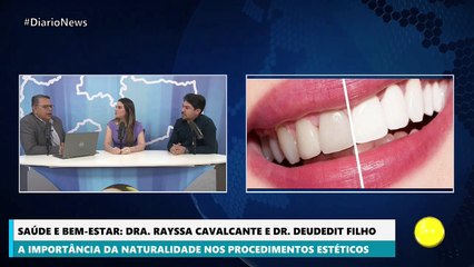 Odontólogos explicam sobre lentes de resina e destacam importância de técnicas para manter estética