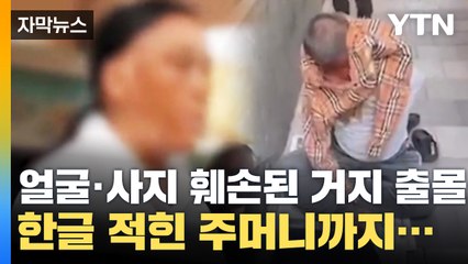 [자막뉴스] 얼굴 녹아내리고 팔다리까지 없다? 거지 대거 출몰 '비상' / YTN