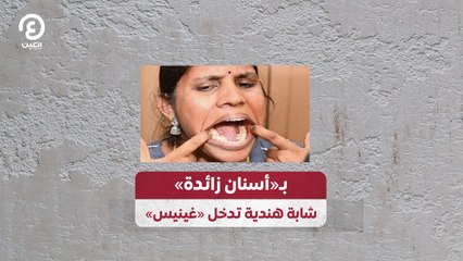 بـ"أسنان زائدة" شابة هندية تدخل "غينيس"