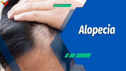 Actitud Saludable | ¿Cómo podemos manejar la caída del cabello asociada a la alopecia?