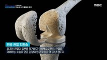 [HOT] ‘Artificial joint replacement’, which replaces damaged joints, MBC 다큐프라임 231119