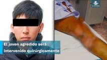 Detienen a presunto agresor del joven que quemaron en una escuela en Texcoco