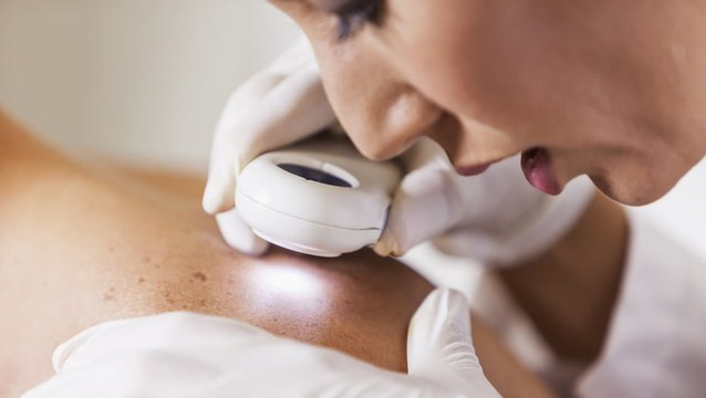 Should You See an Esthetician or a Dermatologist?