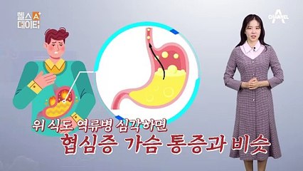 가슴이 쓰리고 화끈하다면 나도 혹시 위 식도 역류병?!