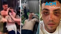 Aussie man's brutal Bali attack at Kuta nightclub