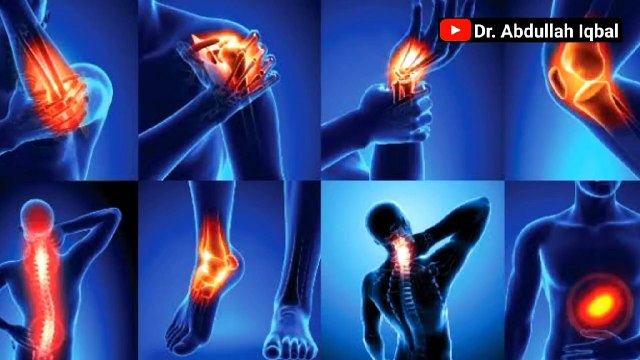 Dengue Fever Symptoms & Dengue Treatment _ Dengue Bukhar ki Alamat aur Ilaj in Urdu