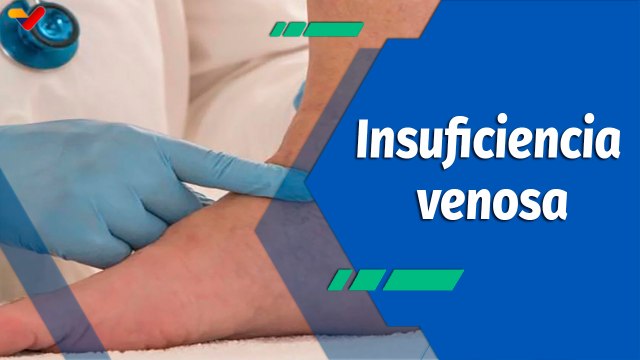Actitud Saludable | Insuficiencia venosa, tipos, causas y consecuencias