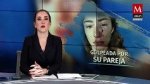 Luchadora nacional Daniela López golpeada brutalmente por su ex pareja